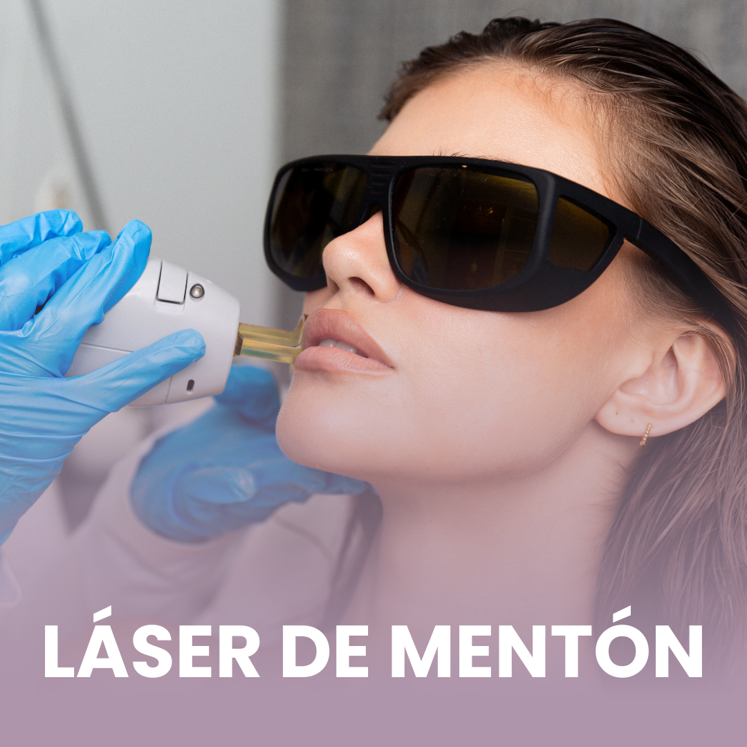 5 Sesiones Laser Mentón