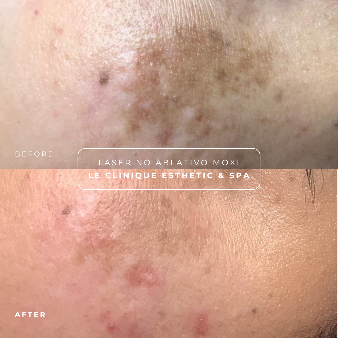 Moxi Party Reservation