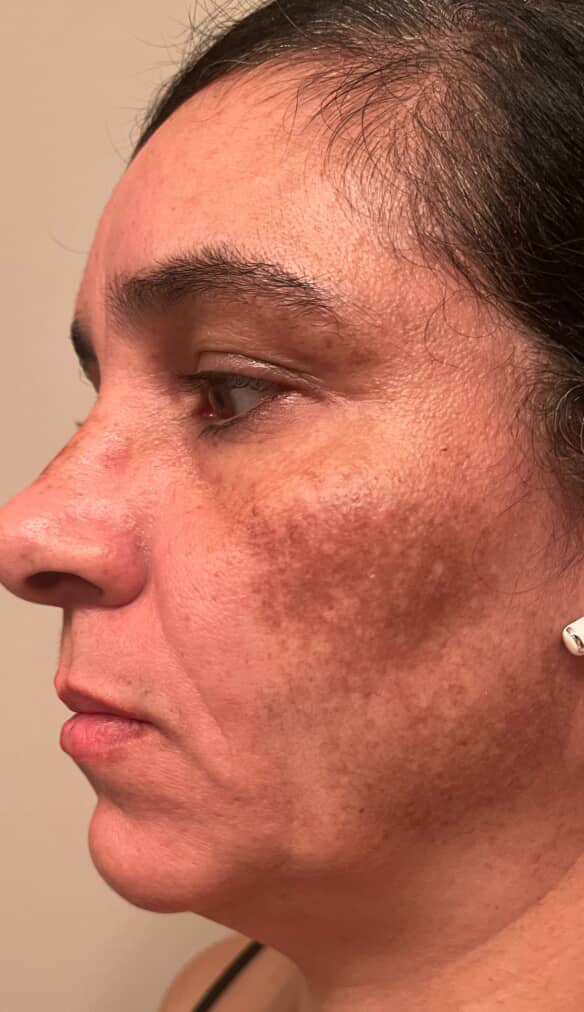 Skincare Carmen Rodriguez