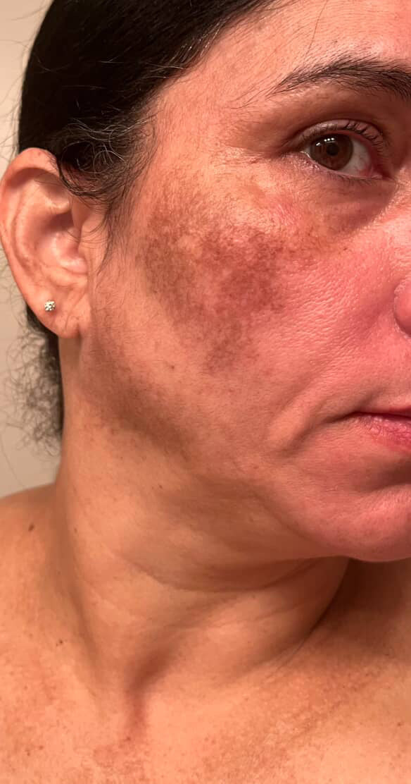 Skincare Carmen Rodriguez