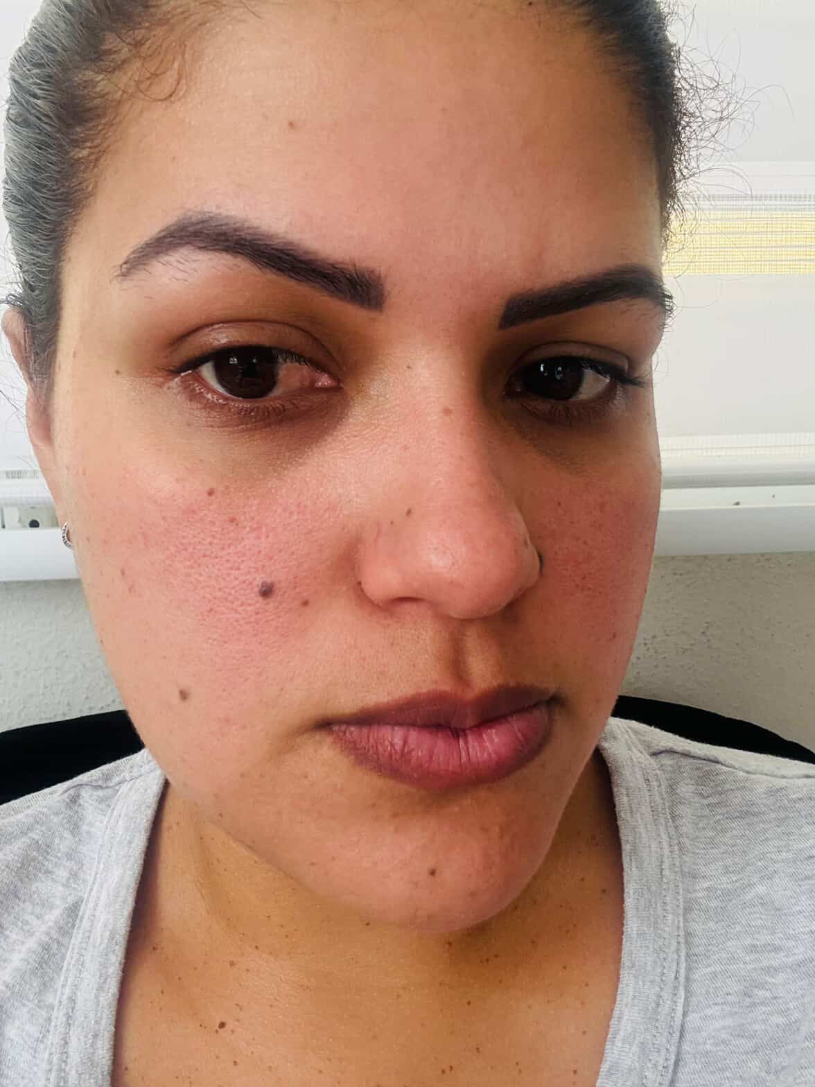 Skincare Leidy Delgado