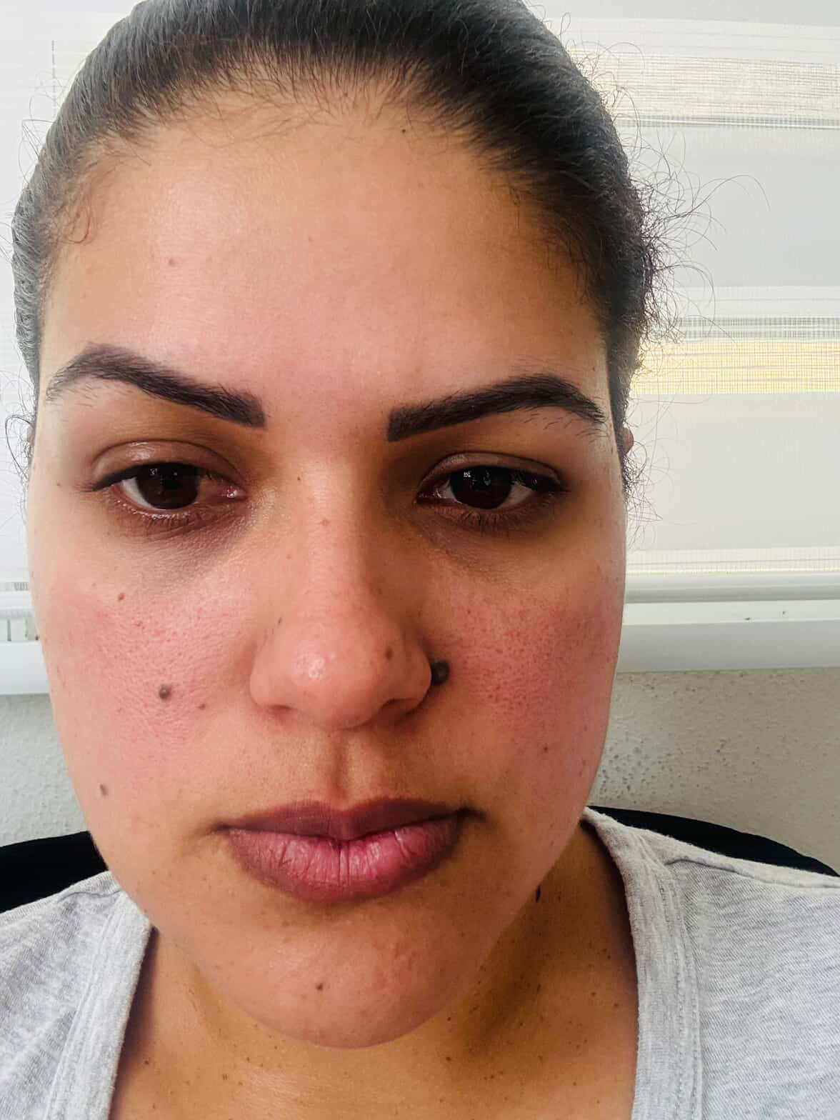 Skincare Leidy Delgado