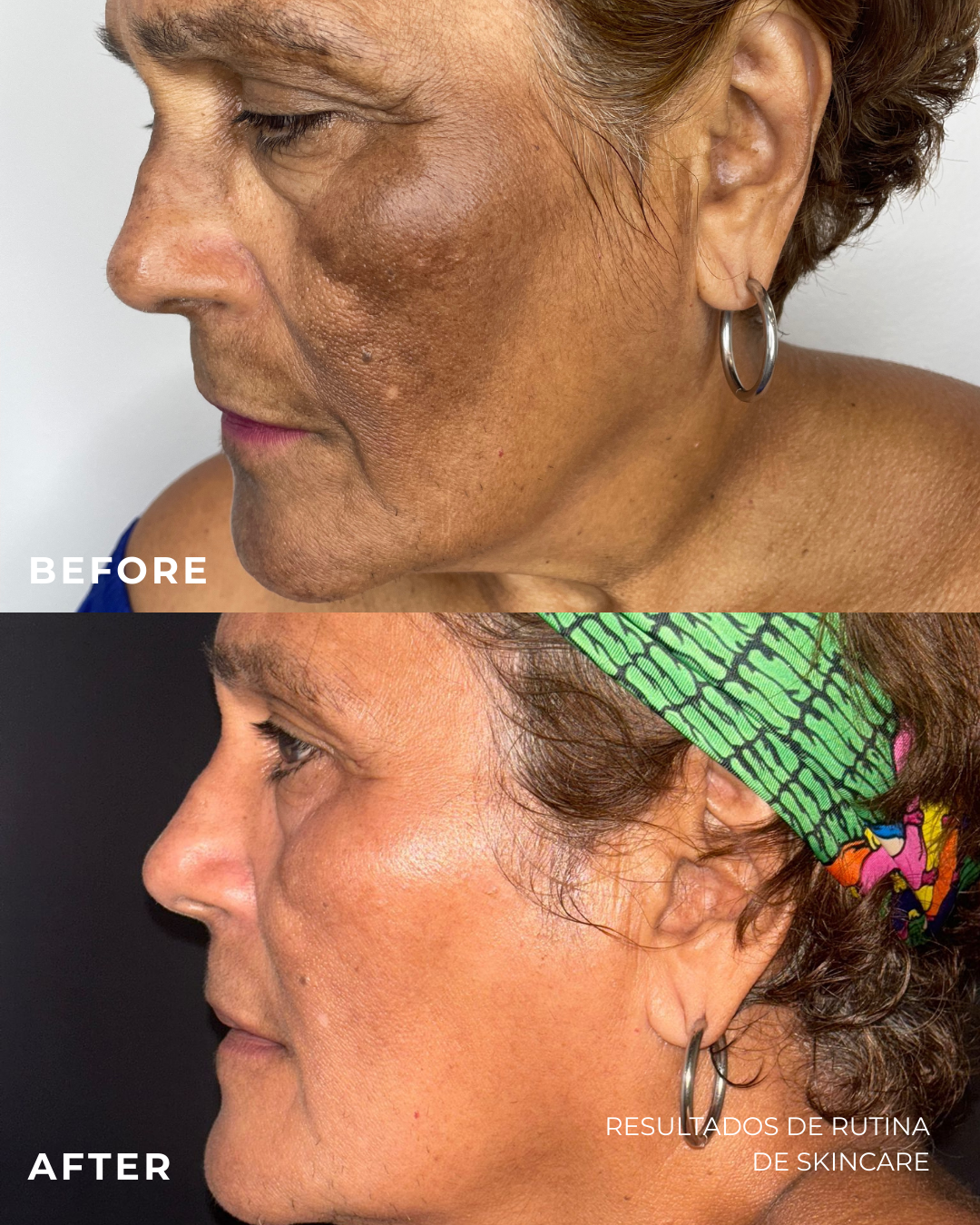 Skincare Consultation