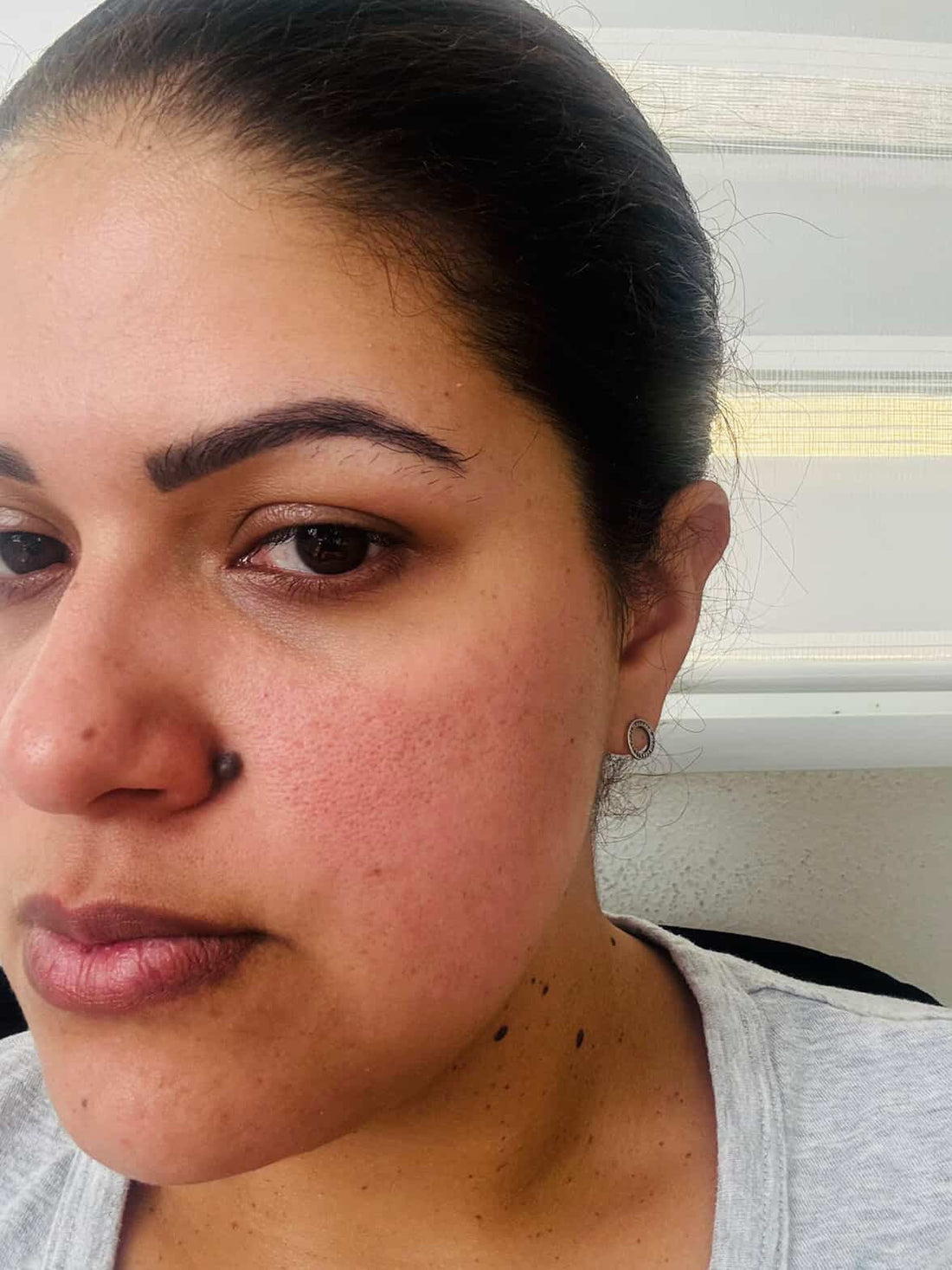 Skincare  Leidy Delgado