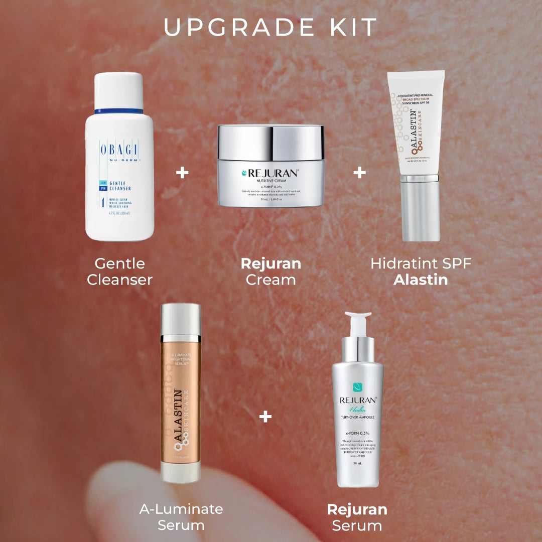 Upgrade Kit