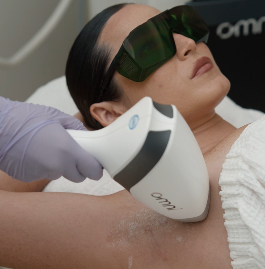 6 sesiones de Láser OMNI Axilas