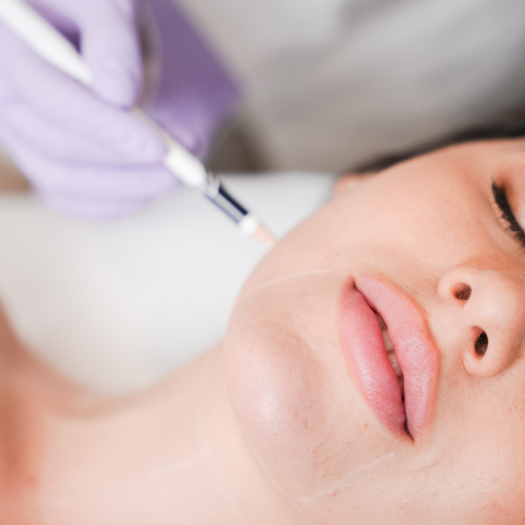 2 sesiones Láser Barbilla