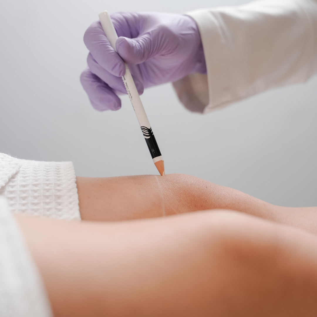 2 sesiones Láser Muslos