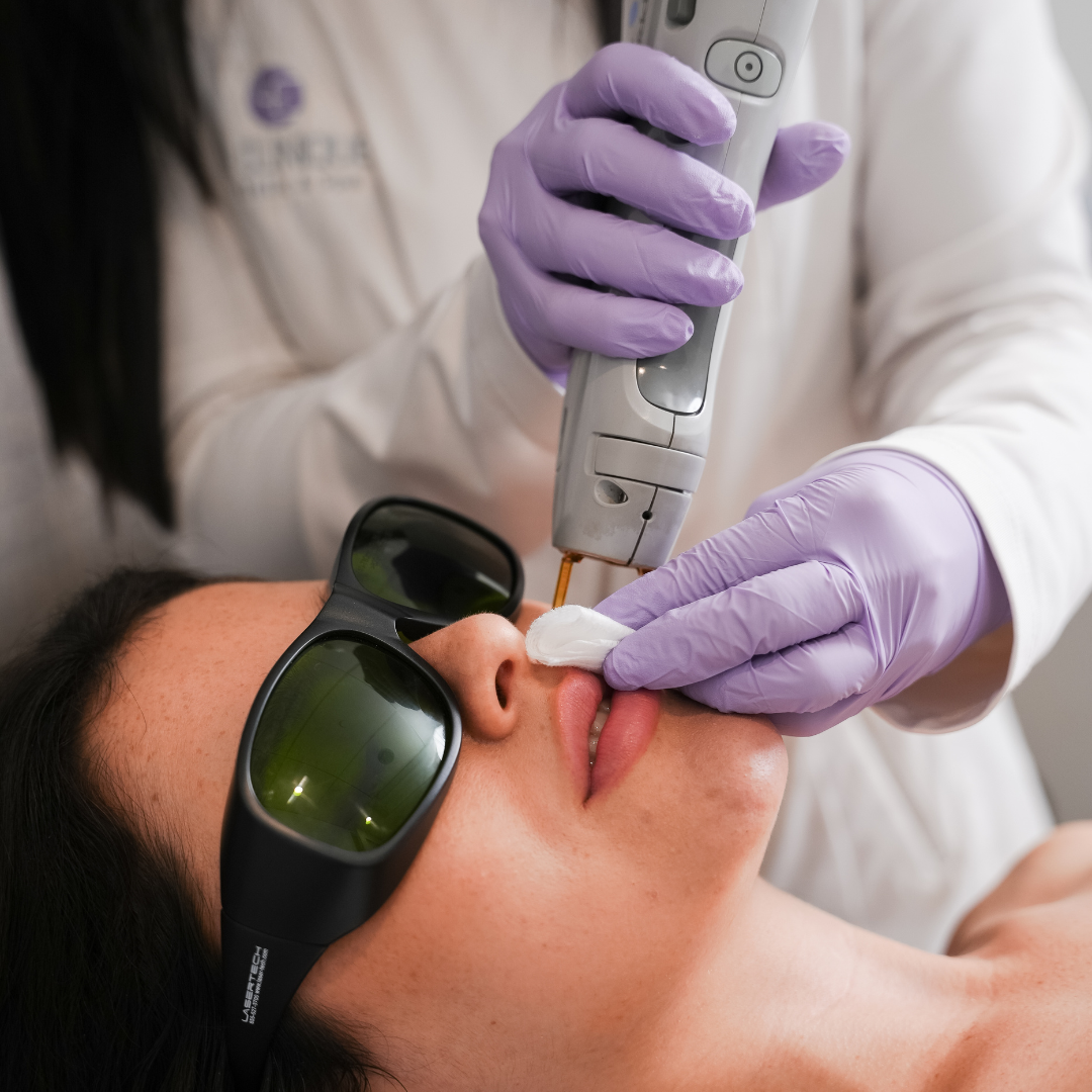 2 sesiones de Láser Bozo