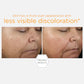 15% Vitamin C + PHA Serum- Neostrata